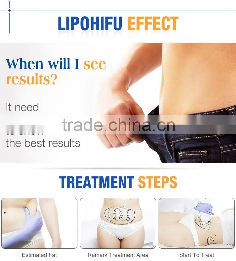 Safe and effective non-surgical fat reduction ultrashape hifu body slimming machine