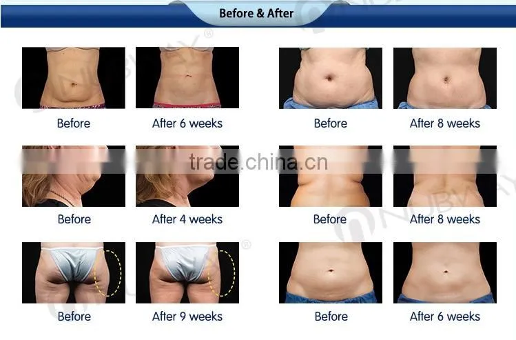 CE approved slim powerful body slimming machine 2016 with 6 handles