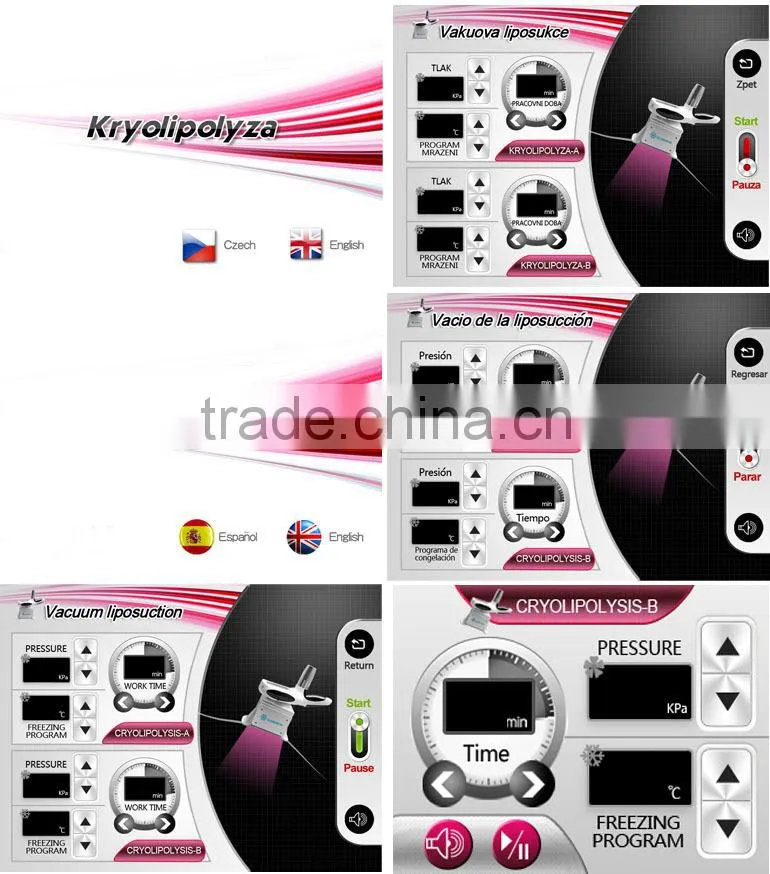 Body Shape Portable Lipolysis Lipo Vacuum Slimming Machine