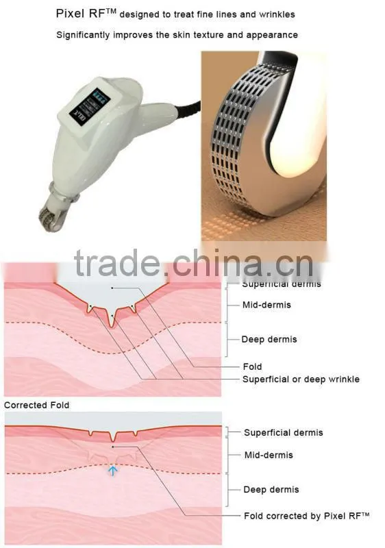 Best PDT ultrasound rf dermabrasion skin care massage for anti wrinkles
