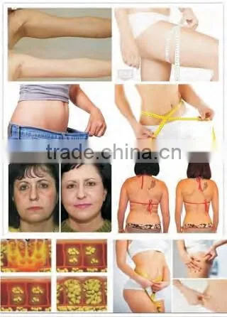 Portable RF Vacuum Roller Slimming Machine With Cavitation For Cellulite Removal