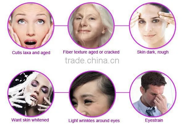 Home rf eye massager facial skin rejuvenation device for anti aging with CE PSE ROHS certificates