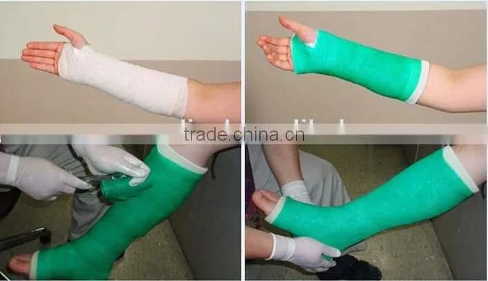 Hot Selling Moisture Resistant Medical Consumbles Orthopedic Fiberglass and Polyester Casting Tape