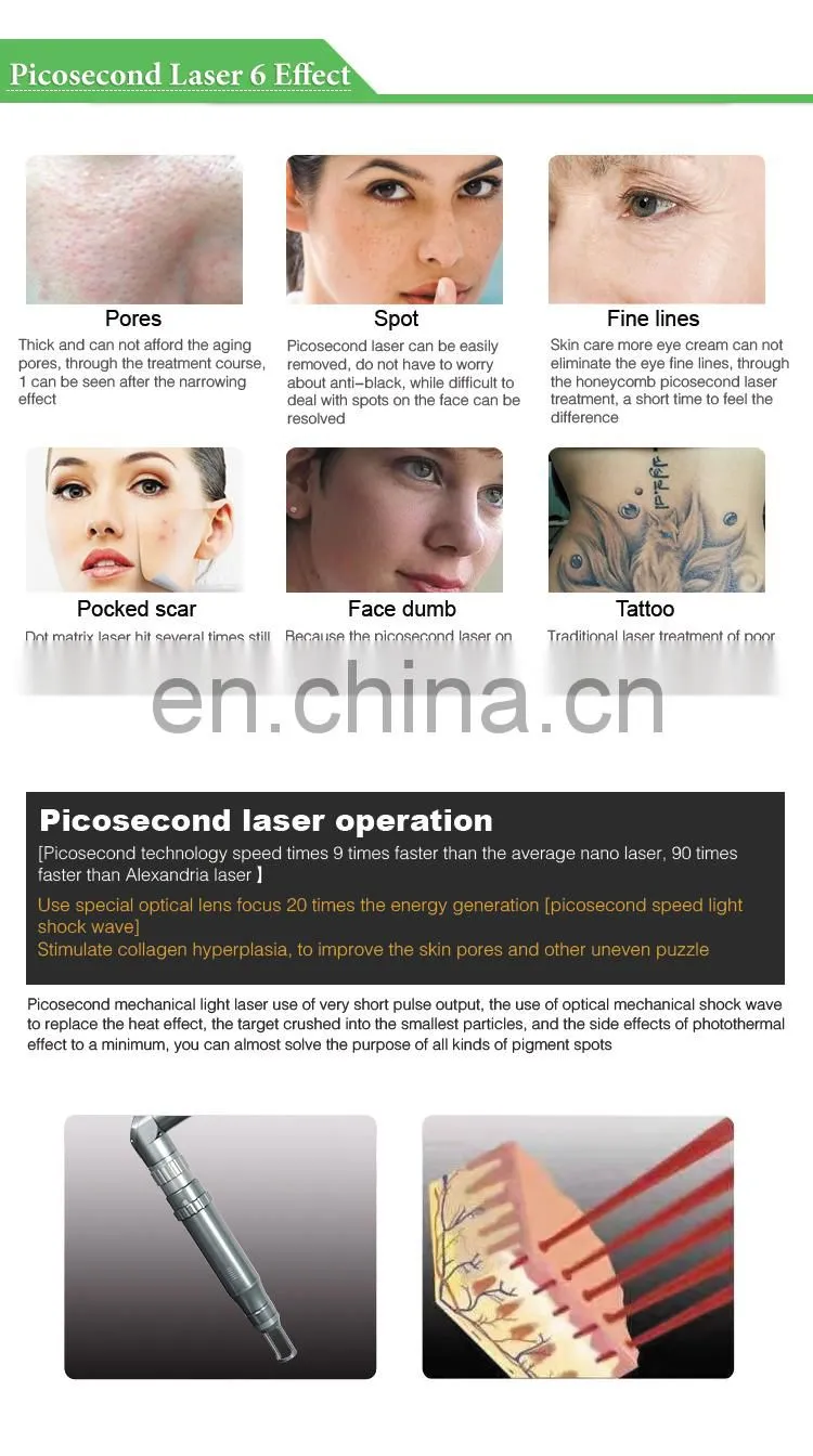 Korea Imported Nd Yag Laser Arm Pigment Tattoo Removal Picosecond Machine 755nm Pico Laser Price