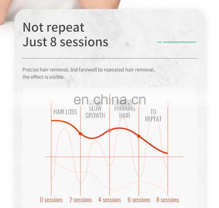 Medical CE TUV 755 808 1064 Diode Laser Hair Removal/ 808nm Diode Laser Hair Removal Machine