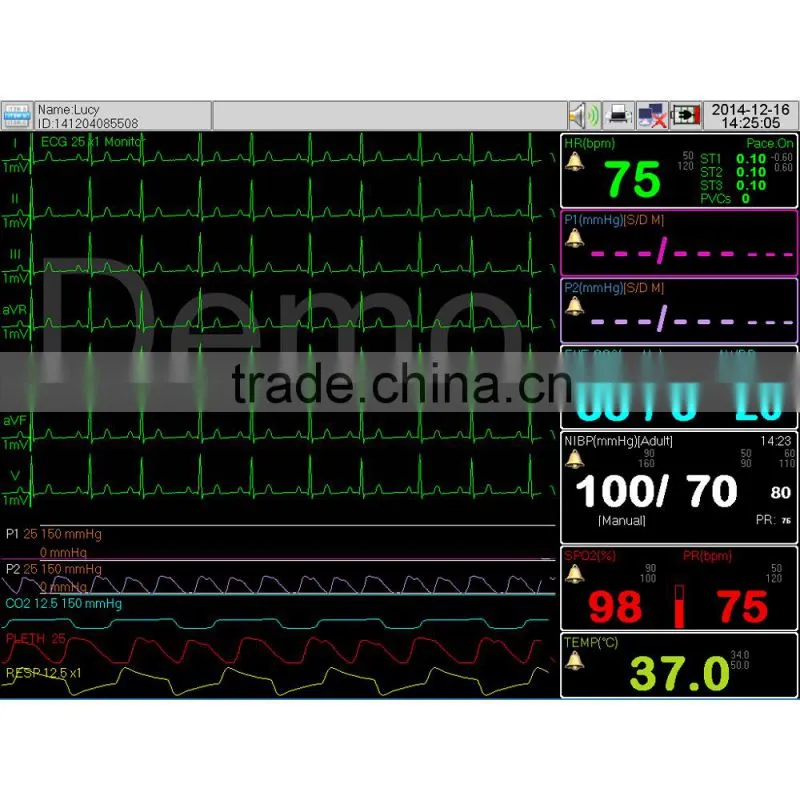 Portable digital vital sign blood pressure monitor