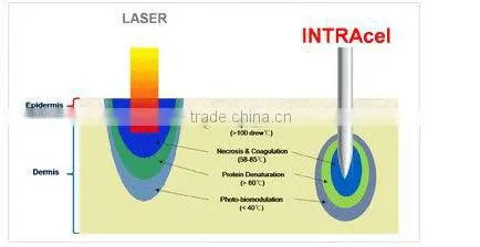 Top performance!!!! microneedle skin treatment portable fractional rf