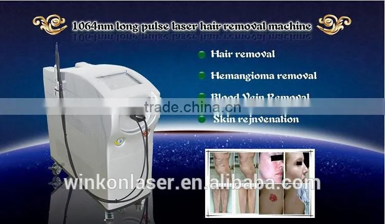 Long pulse nd yag 1064 nm hair removal laser for kinds of color