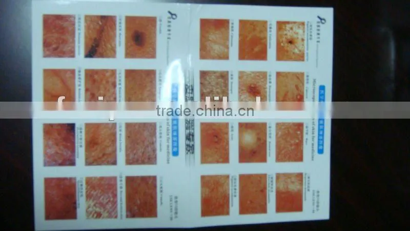 VY-T07 High qulity skin and hair scanner analysis machine