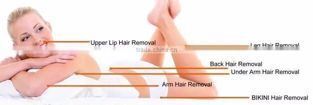 Deep color hair removal 808nm diode laser