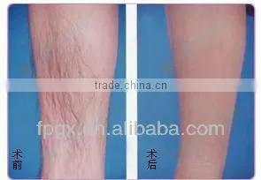 Portable mini ipl machine