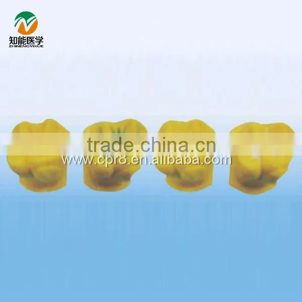BIX-L1032 tooth pit and fissure sealing demo model