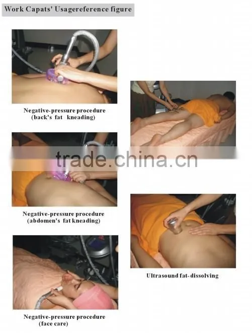 ultrasound/bio microcurrent handheld vacuum suction massage machine