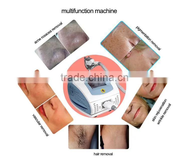 KES-Med150 FDA approval portable ipl+rf style beauty equipment for hair removal machine