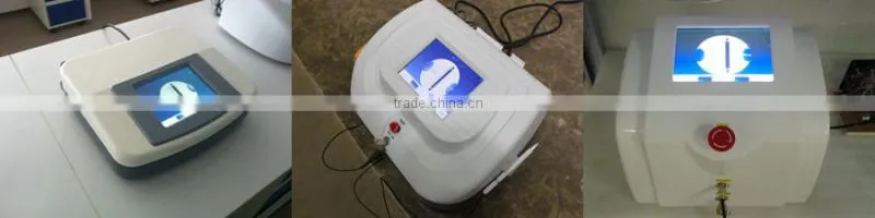 RBS 30MHz High Frequency laser spider vein removal machine for sale