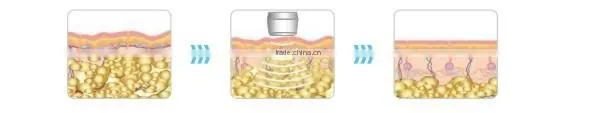 Beauty Salon Equipment High Quality ultrasonic cavitation machine price Beauty Device