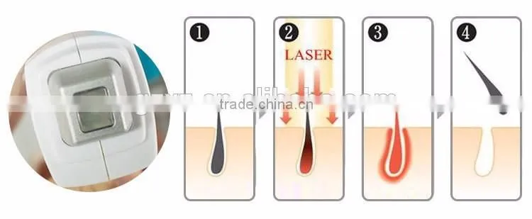 Best selling products 808nm diode laser hair removal machine for beauty salon equipment