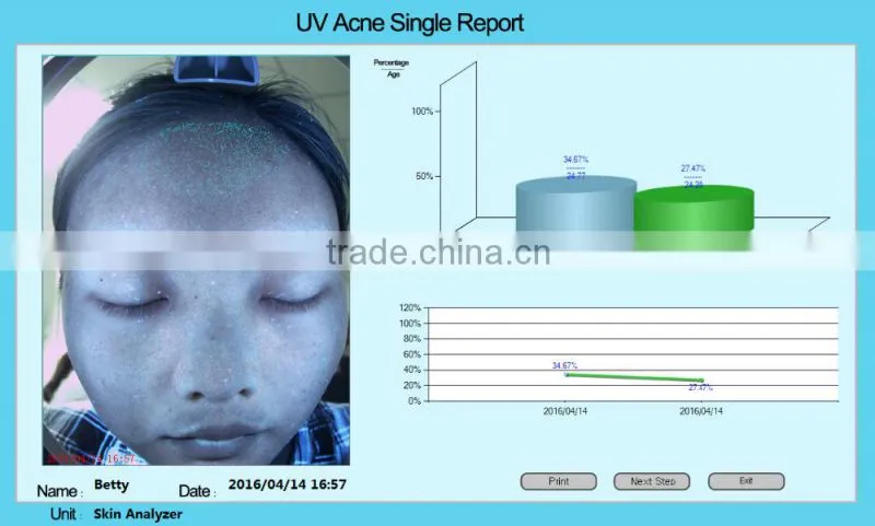 best magic 3d facial skin analyzer with camera beauty salon machine LD6021C
