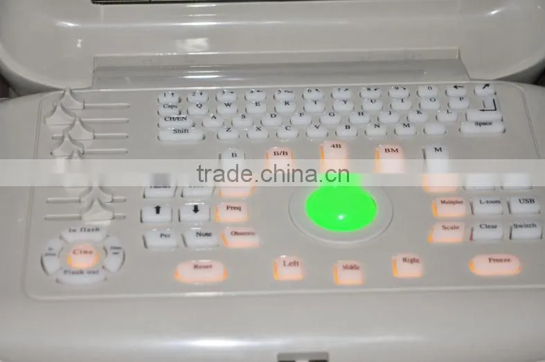 2016 CE Approved Digital Portable Style Ultrasound Machine/Scanner with cheap price