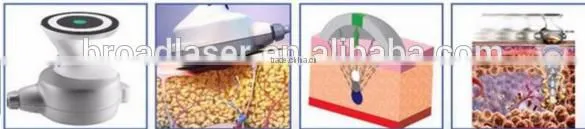 Ultrashape new slimming technology machine cavitation slimming machine