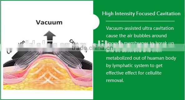 Ultrasonic cavitation+ RF+Vacuum liposuction system/CE and 2 years warranty