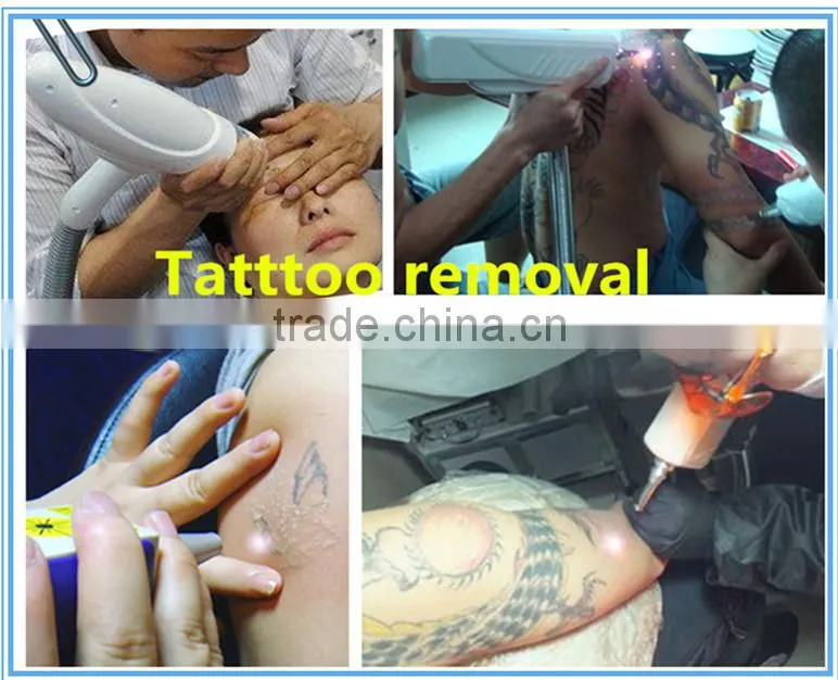 cheap q switch nd yag tattoo removal laser machine with top quality and medical ce approval