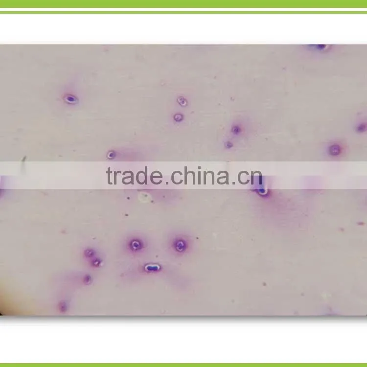 Silicate Bacterium bio potassium releasing bacteria powder organic fertilizer