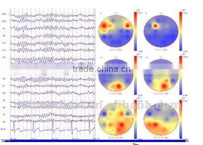 EEG device 24-channel portable machine