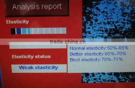 Distributor price!!! 2015 newest skin analyzer software for salon use