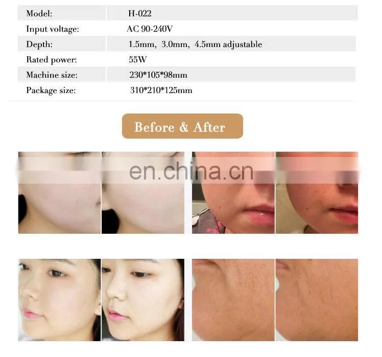 Hello Skin Ultrasound Skin Lifting Anti-Ageing Wrinkle Removal Facial Care