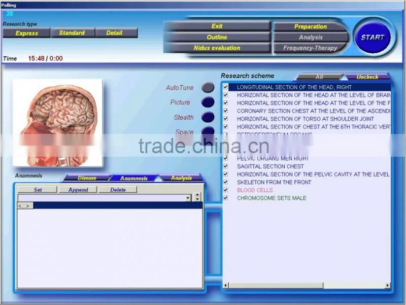 alibaba china suppliers quantum magnetic diagnostics health analyzer auto professional 3D NLS