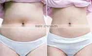 N8 Vacuum body slimming beauty Machine For Beauty Solon
