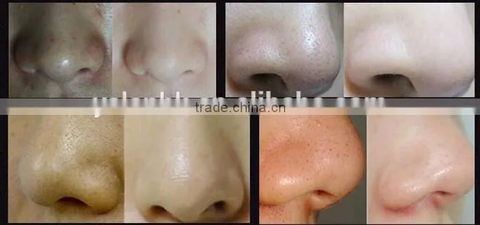 Dead Sea Mud Deep Cleansing Blackhead Killer Blackhead Remove Peel Off Mask