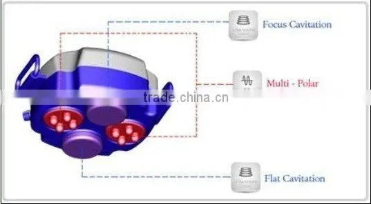 Ultrasonic Cavitation Slimming Equipment (Portable)