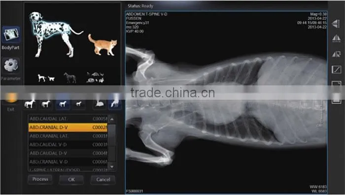 good selling cheapest price 14*17 inch FPD digital x ray flat panel detector