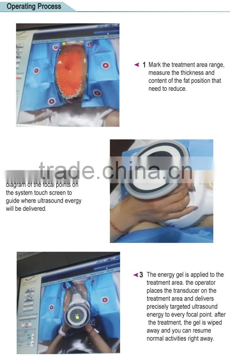 Ultrasound Shape with new slimming technology machine