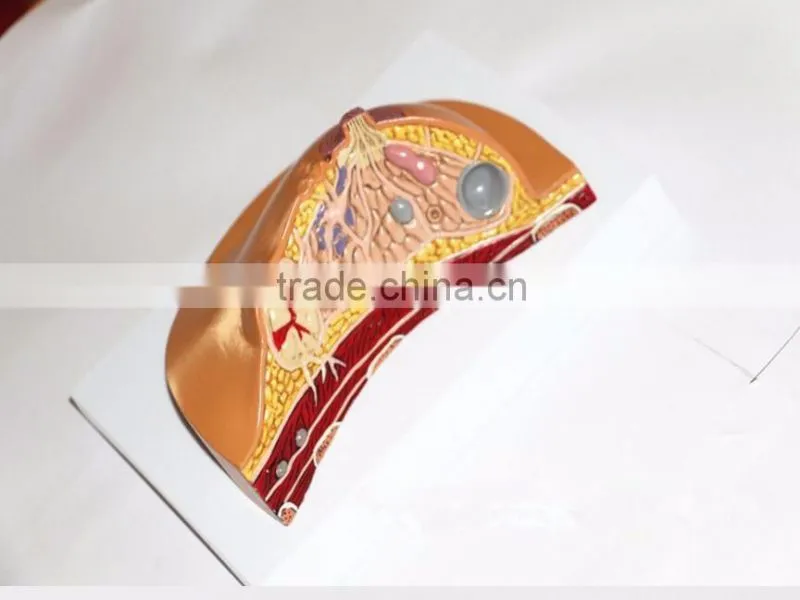 Medical breast disease model breast anatomical model medical training model breast feeding model