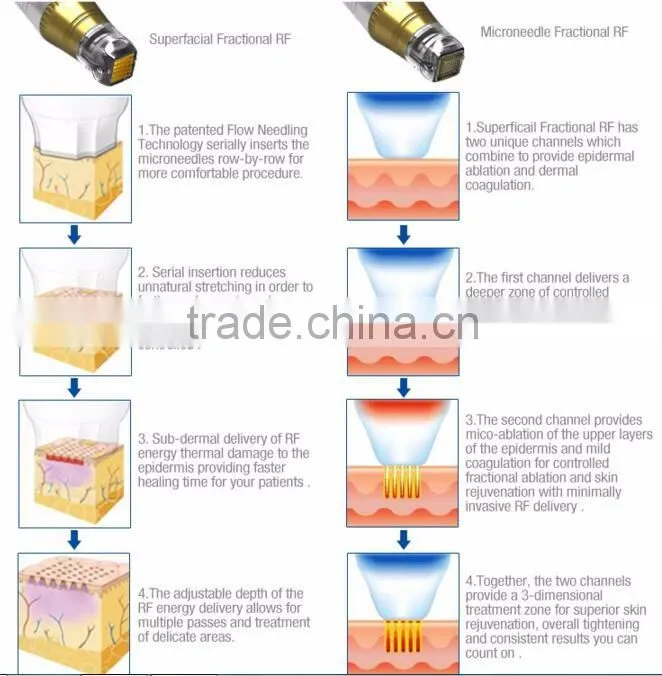 Salon use 5MHZ RF skin tightening face lifting beauty machine monopolar rf machine