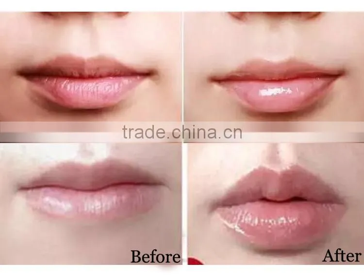 cute ball shape lip plumper/lip stick/lip balm container with private label