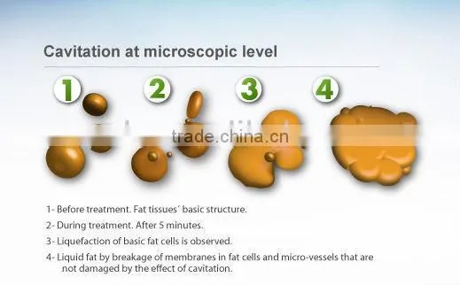 ultrasound therapy machines HS 530RV portable ultrasound therapy machine by shanghai med apolo medical tech