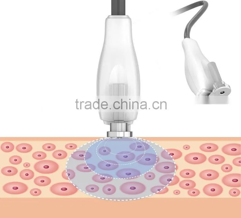 2014 Newly RF Cyclone Bady Shape Skin Care Equipment