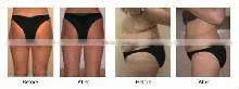 weight reducing machine