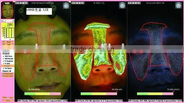 WT-03-S Super Trispectrum Magic mirror skin scanner analyzer