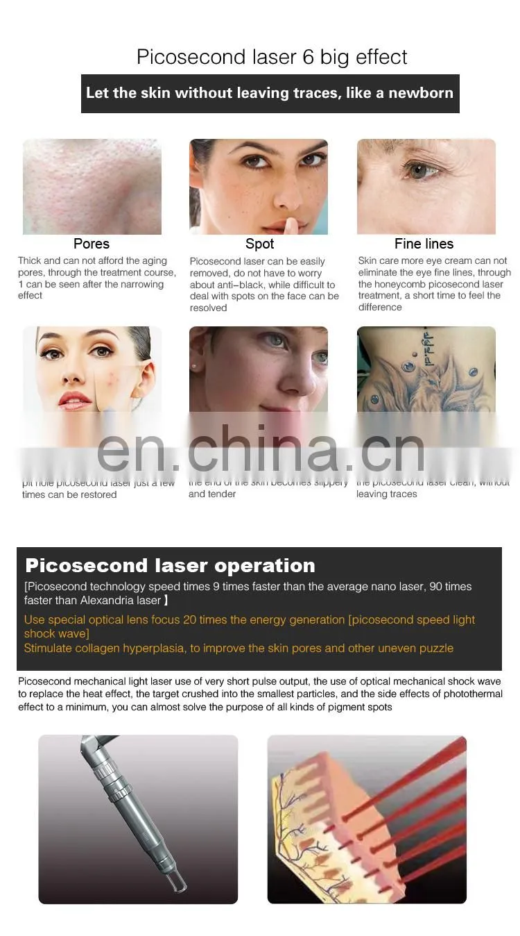 755nm Laser Pico Picosecond Laser Birthmark/ Tattoo Removal Skin Whitening Machine