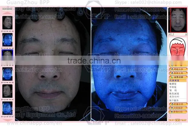 RGB and UV spectrum skin analysis camera for analysis skin characteristic
