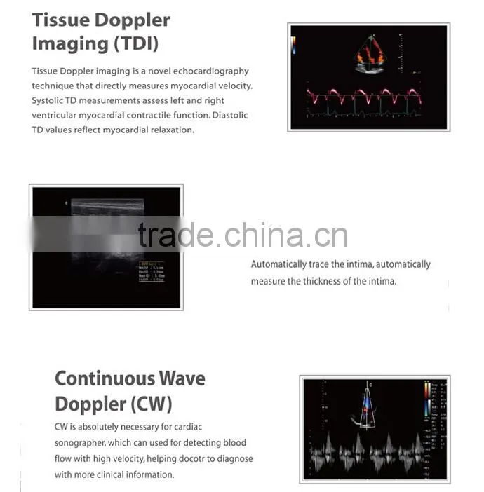 Laptop Color Doppler Ultrasound Price & portable color doppler ultrasound machine