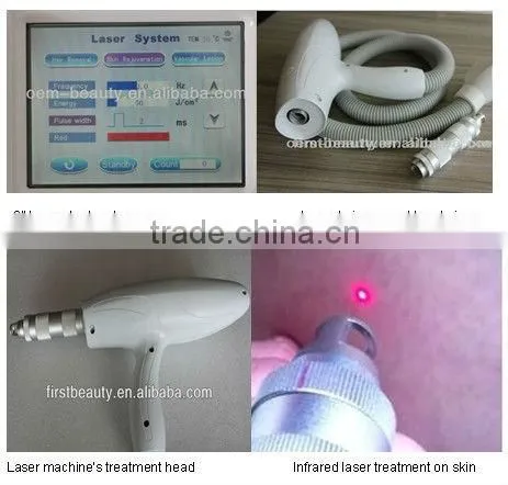 Professional 1064 Long pulsed hair remover laser vascular removal - P003