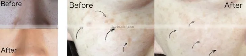 Easy-to-use carbonated disposable face mask for sale