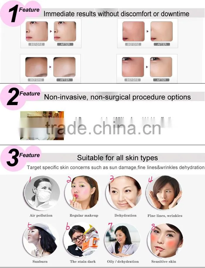 Water diamond vacuum microdermabrasion Skin Peeling System Oxygen Infusion