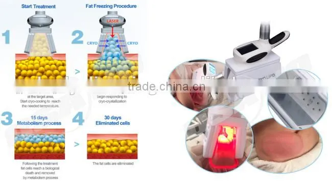 Spa salon equipment lipo vacuum massageskin cooling machine for laser